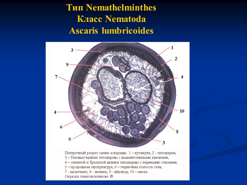 Тип Nemathelminthes Класс Nematoda Ascaris lumbricoides